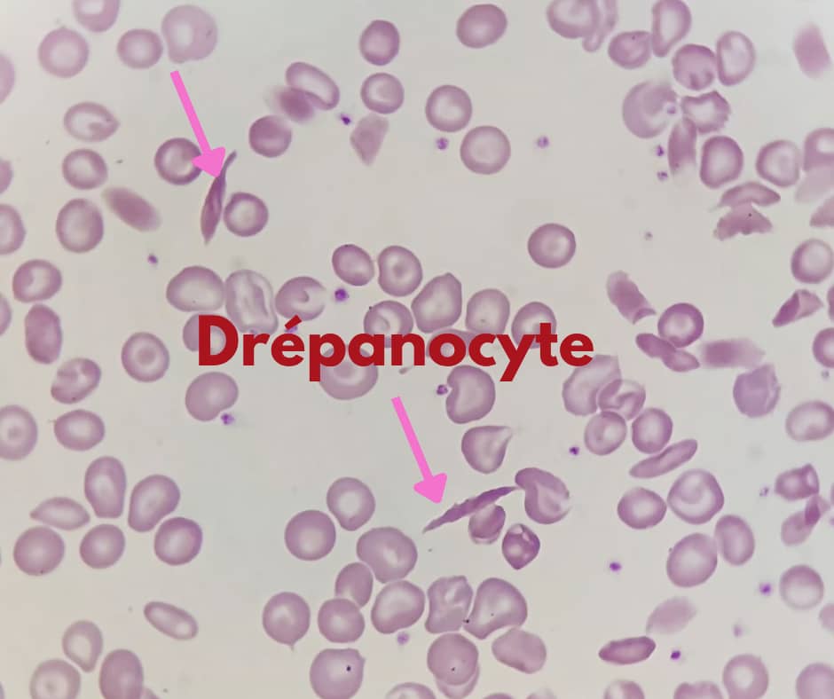 al shamel lab tenes 17