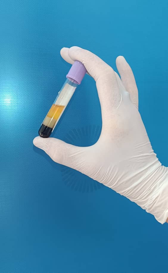 al shamel lab tenes 18