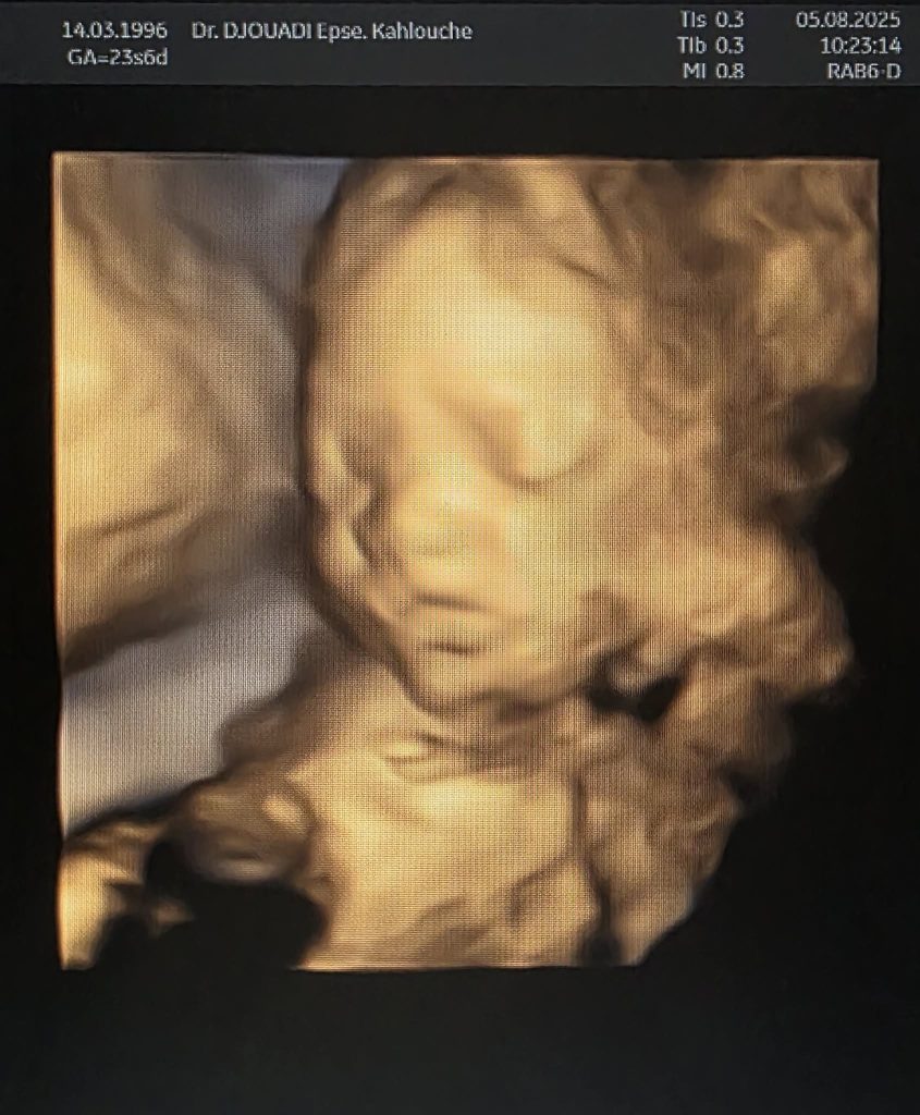 djouadi gynecologue bachdjerrah