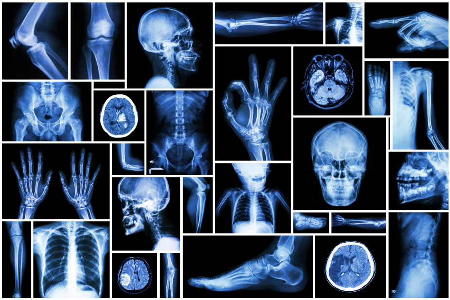 radiographie