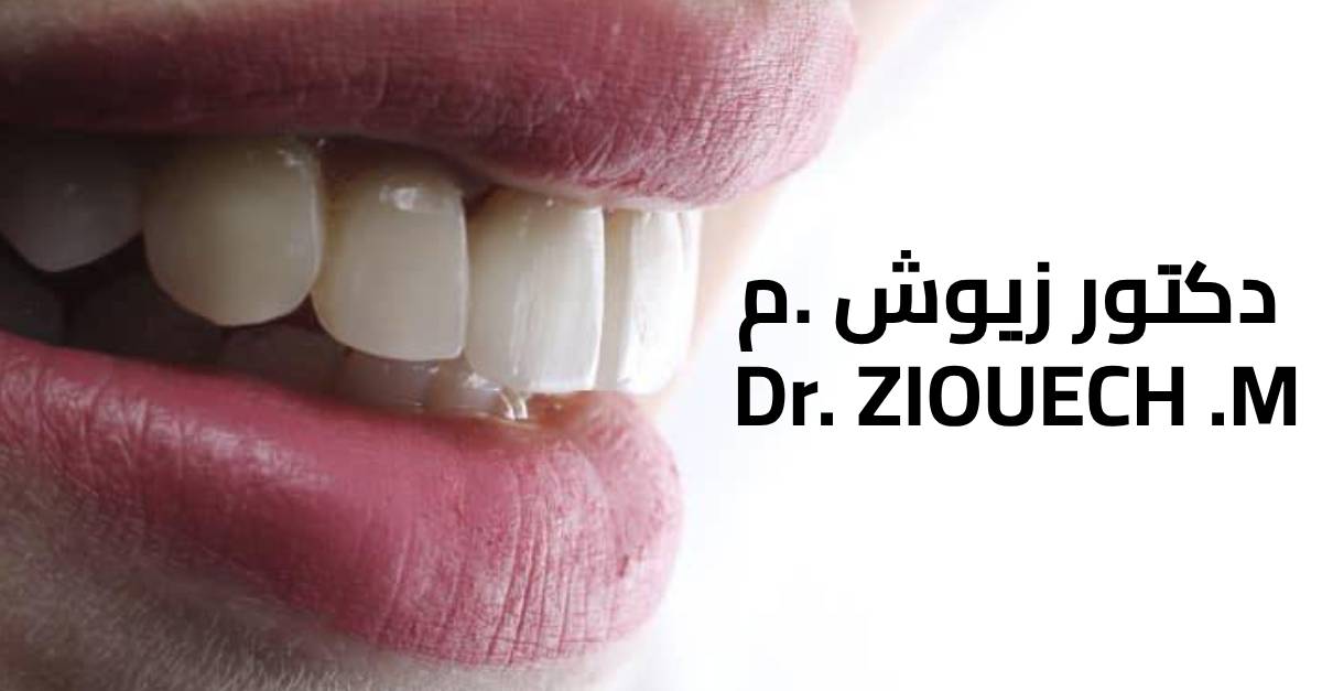 drziouech cover
