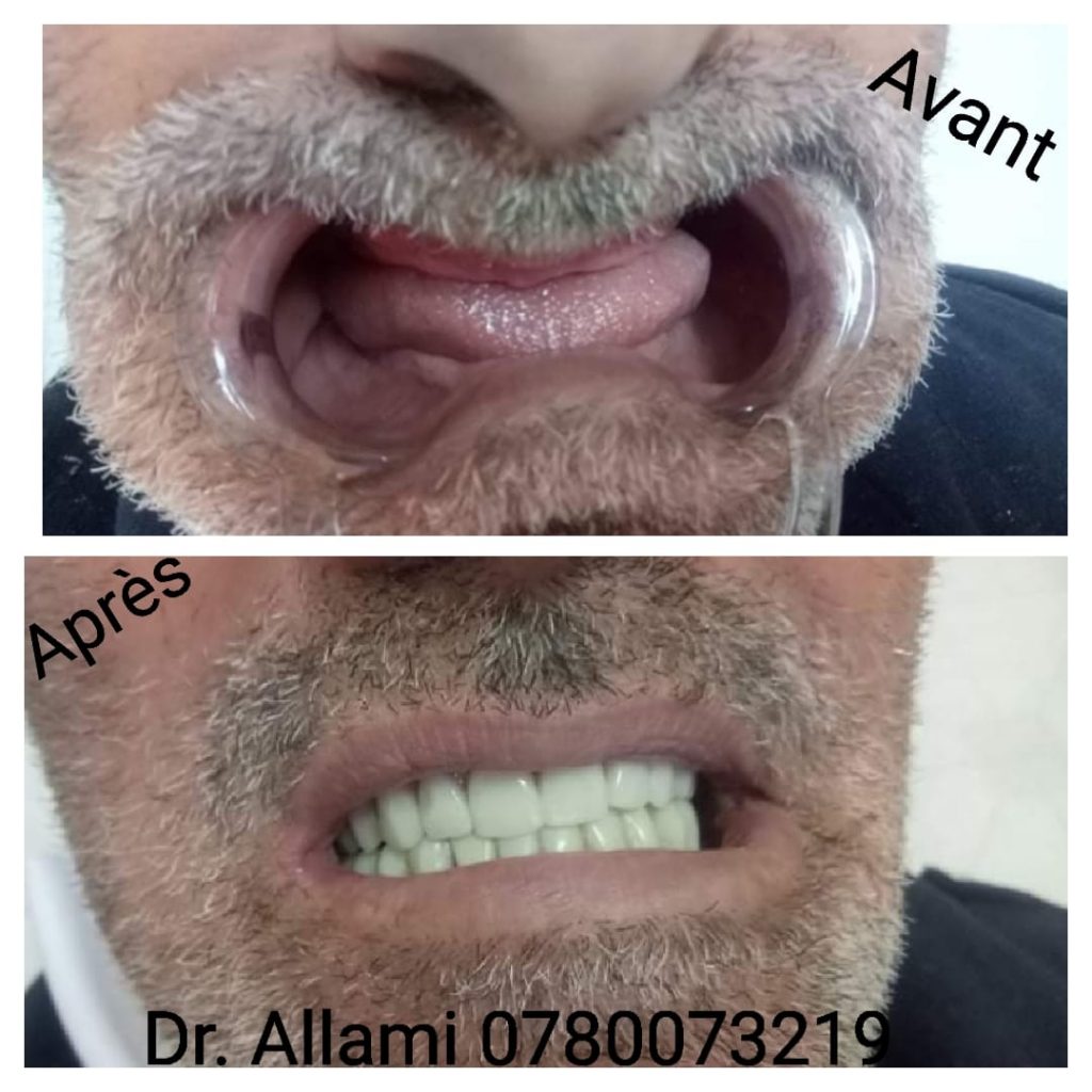 DrAllami01
