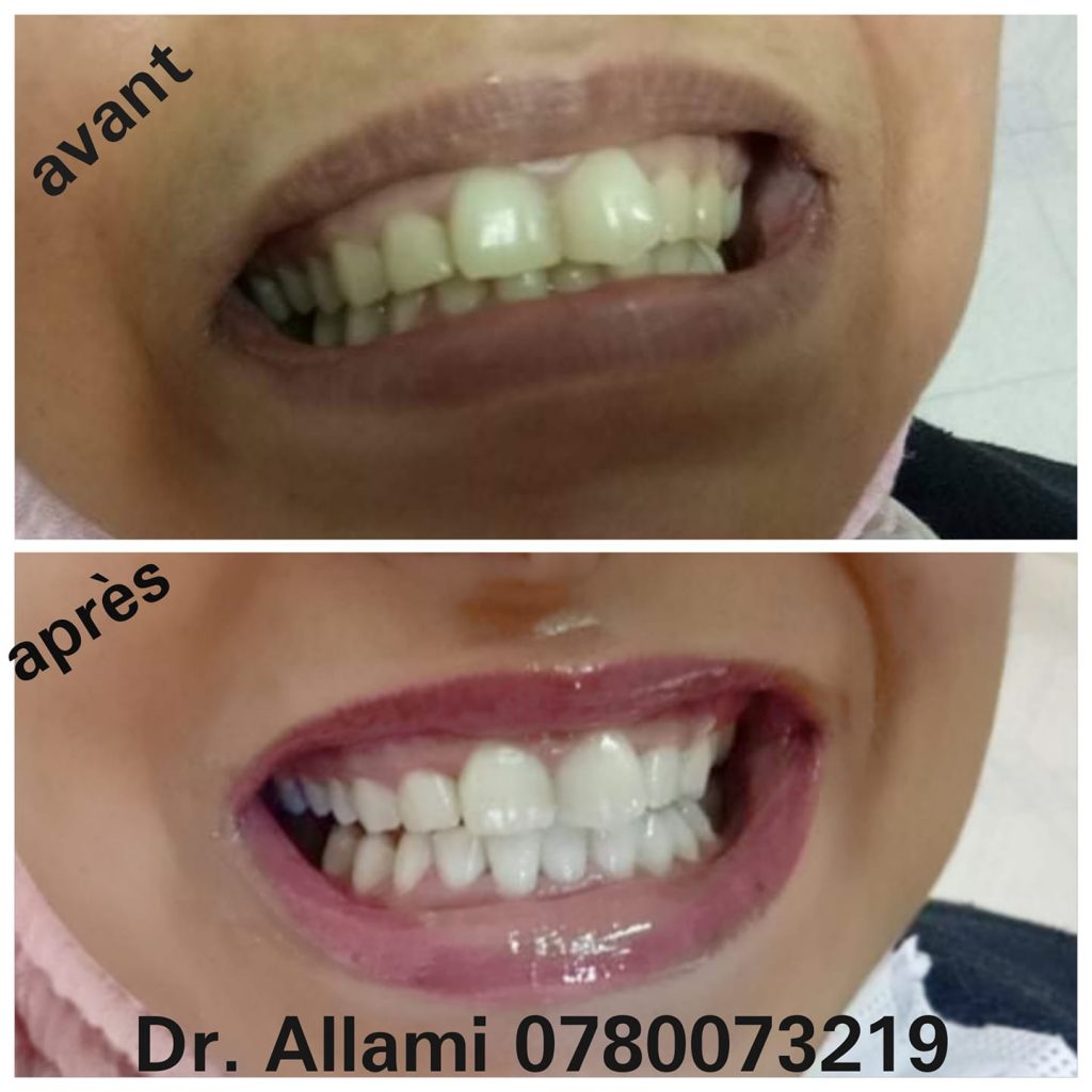 DrAllami02