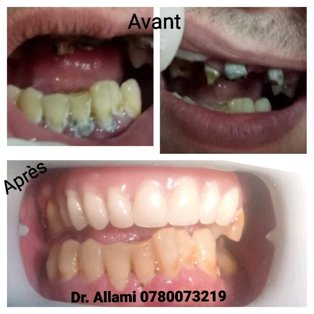 DrAllami03