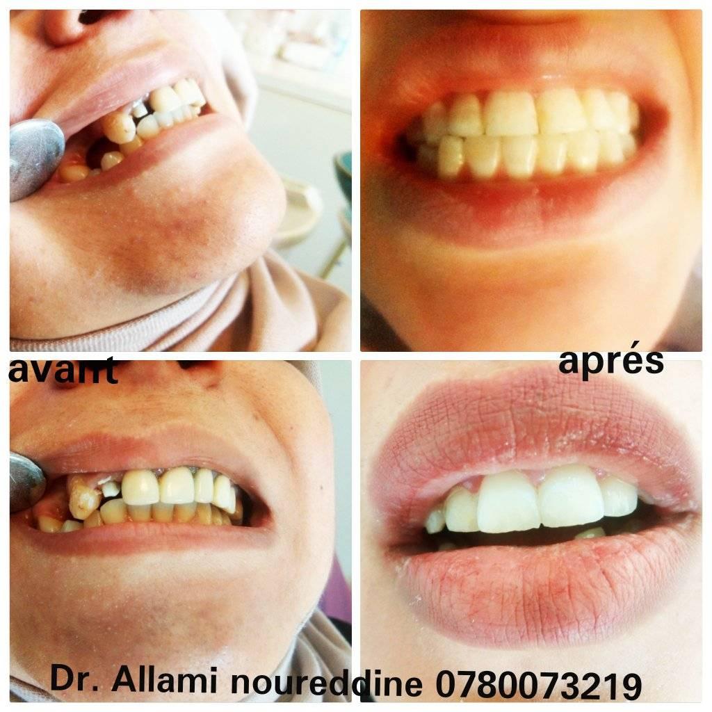 DrAllami10