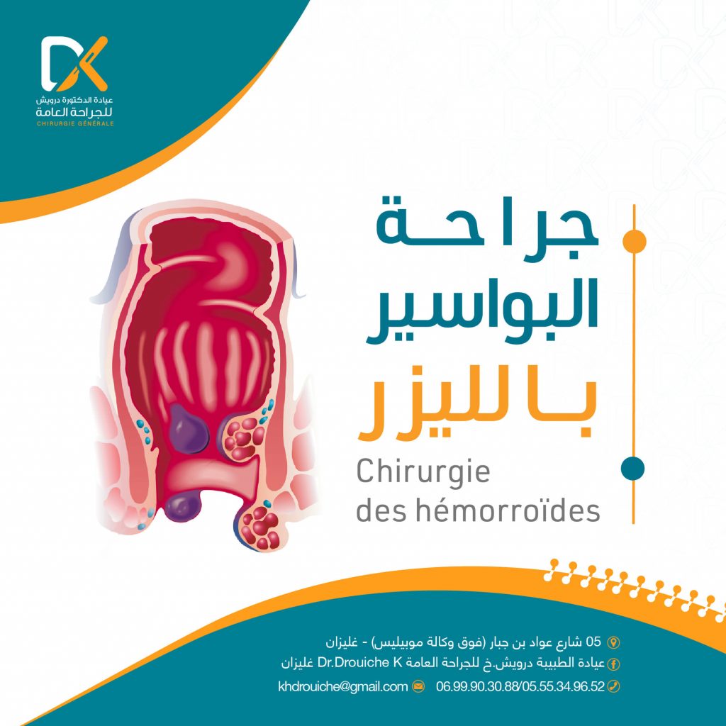 drouiche chirurgienne coelio relizane 33