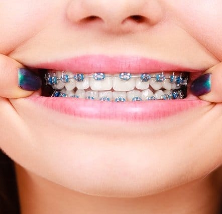 ouir dentiste odf blida 03