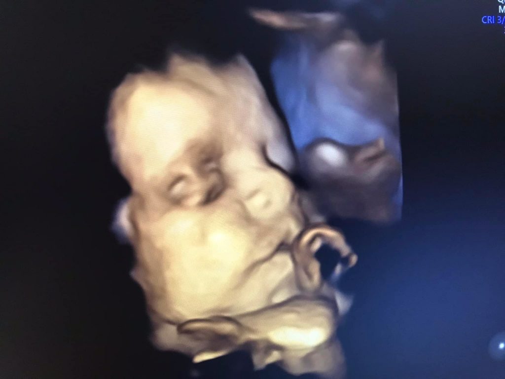 bouras gynecologue tenes chlef 10