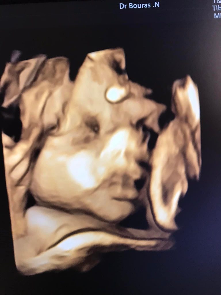 bouras gynecologue tenes chlef 12