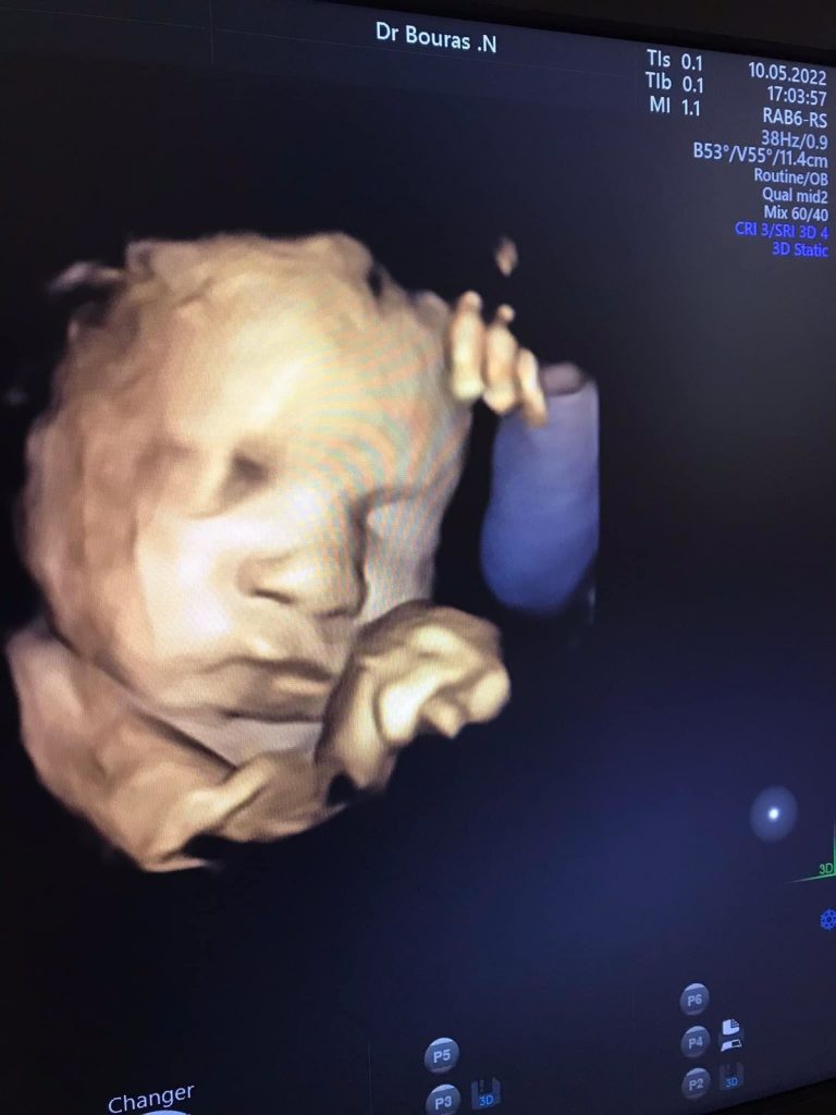 bouras gynecologue tenes chlef 13