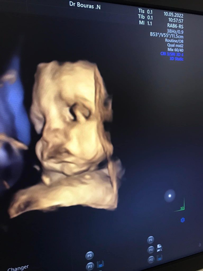bouras gynecologue tenes chlef 14
