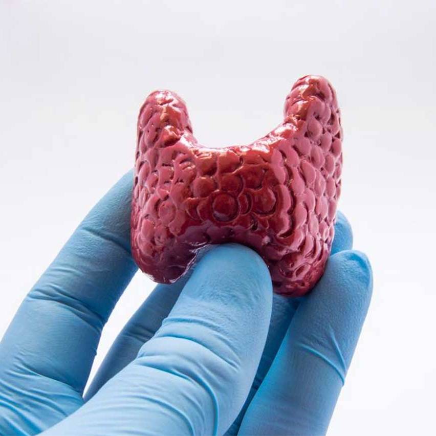 thyroid000