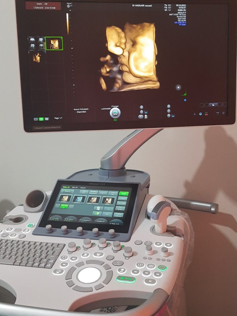 houari gynecologue ouled fares chlef 02