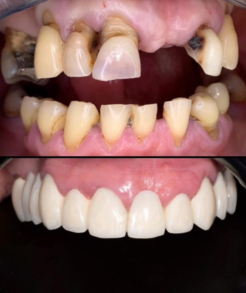 Taibi t dental bab ezzouar dentiste alger14