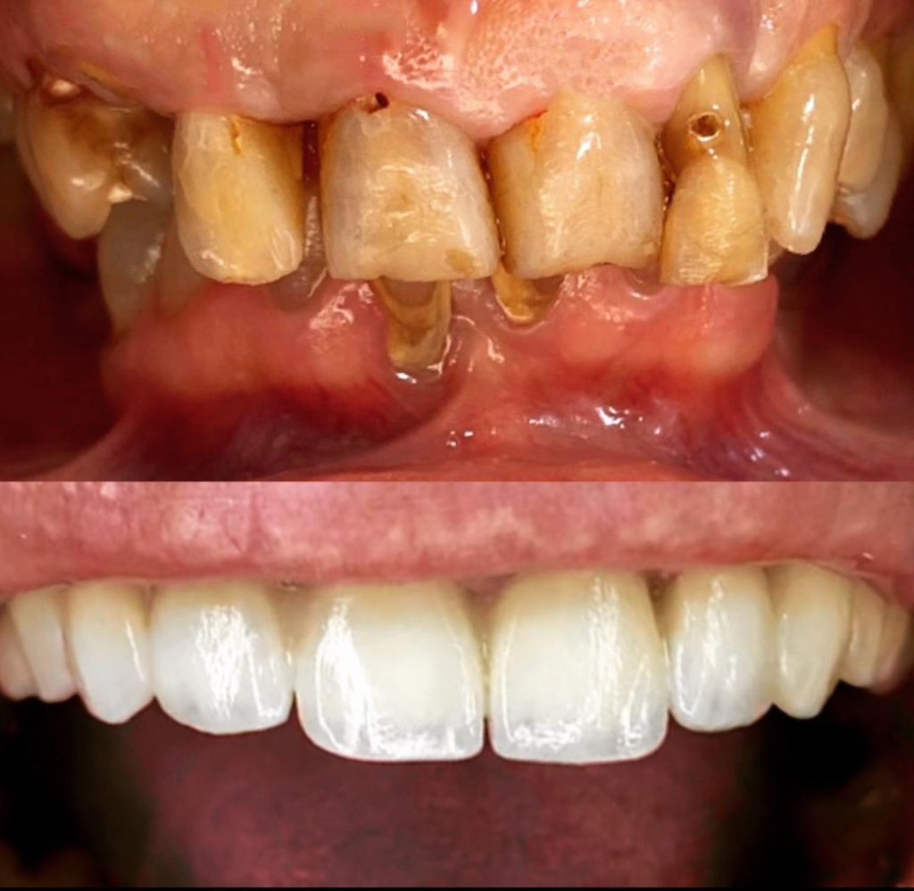 Taibi t dental bab ezzouar dentiste alger15