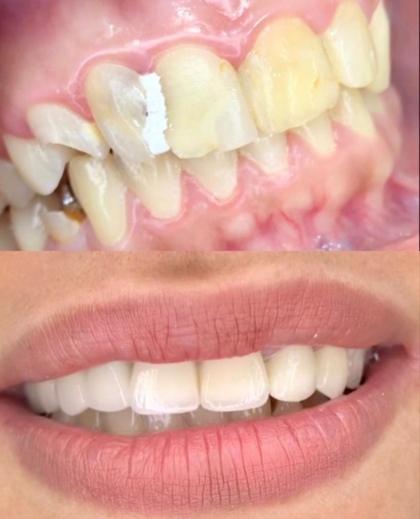 Taibi t dental bab ezzouar dentiste alger16
