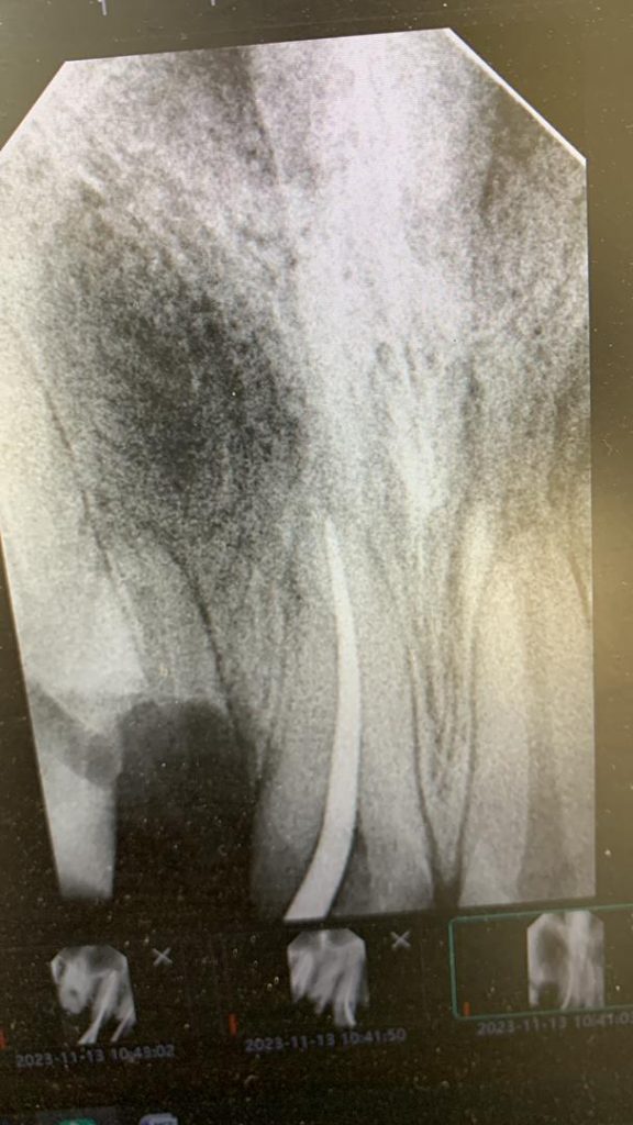 Taibi t dental bab ezzouar dentiste alger17