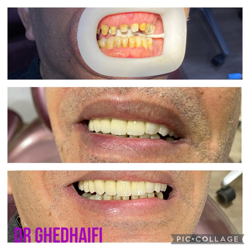 ghedhaifi 02