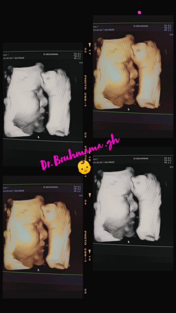 Bouhmama gynecologue ouled fares 13