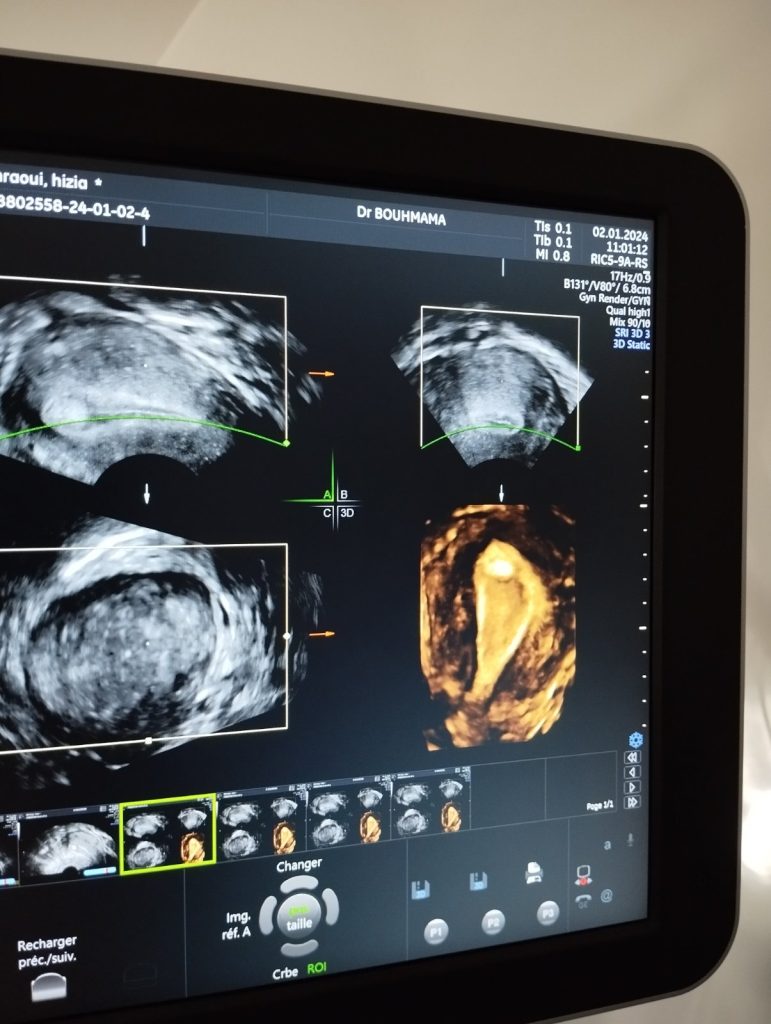 Bouhmama gynecologue ouled fares 16