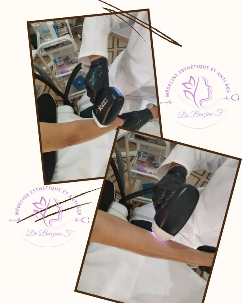 benzina esthetique relizane 19