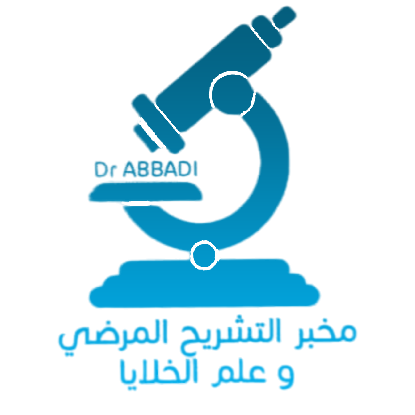 abbadi