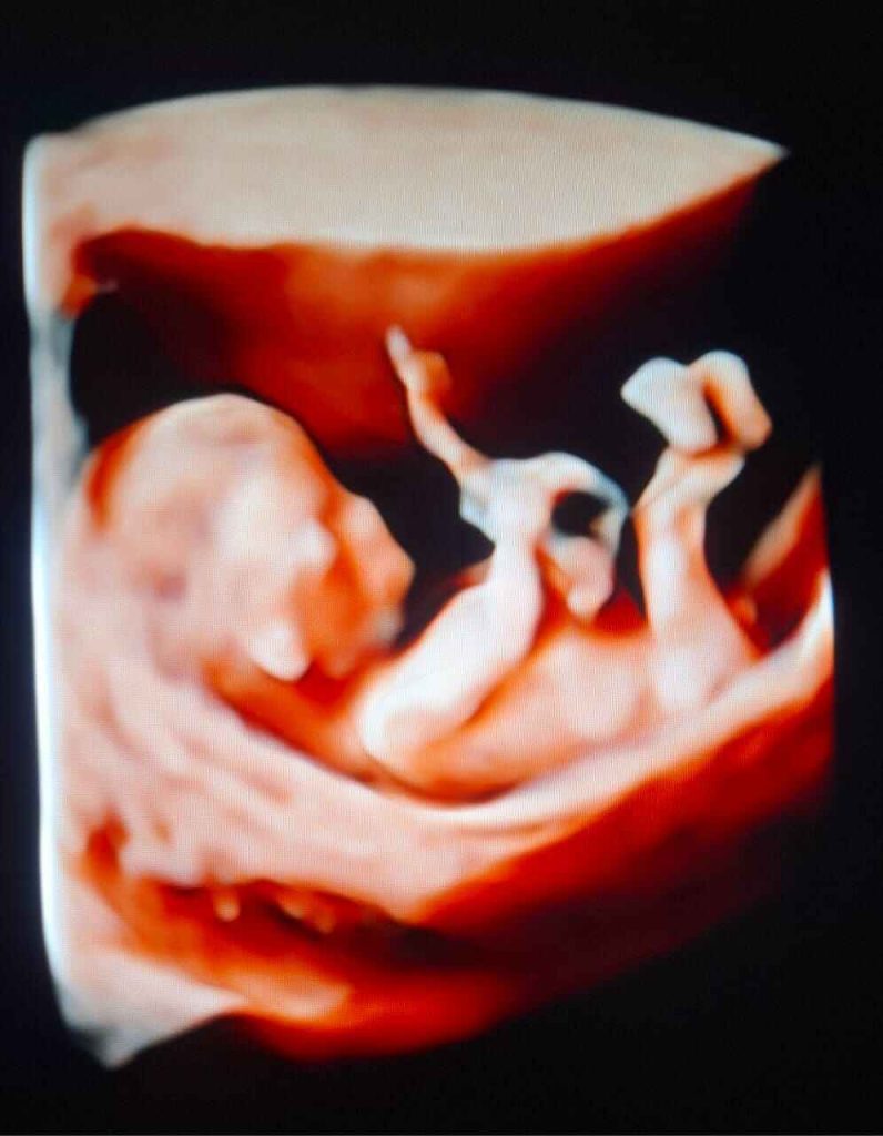 khennouf gyneco bba 13