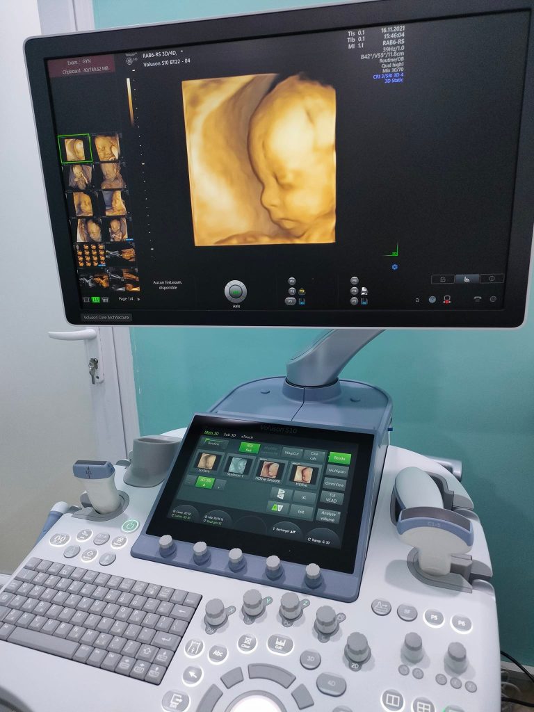 bechami gynecologue bba 12